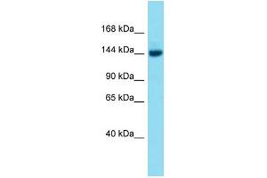 Host:  Rabbit  Target Name:  Brpf3  Sample Type:  Mouse Liver lysates  Antibody Dilution:  1. (BRPF3 antibody  (Middle Region))