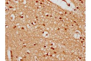 IHC image of ABIN7174162 diluted at 1:300 and staining in paraffin-embedded human brain tissue performed on a Leica BondTM system. (UTP18 antibody  (AA 13-152))