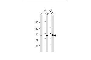 All lanes : Anti-DCLK1 Antibody at 1:4000 dilution Lane 1: human brain lysate Lane 2: mouse brain lysate Lane 3: TT whole cell lysate Lysates/proteins at 20 μg per lane. (DCLK1 antibody)