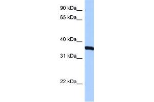 WB Suggested Anti-RPLP0 Antibody Titration:  0. (RPLP0 antibody  (N-Term))