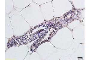 Formalin-fixed and paraffin embedded rat cells labeled with Anti-CCR4/CD194 Polyclonal Antibody, Unconjugated (ABIN738666) followed by conjugation to the secondary antibody and DAB staining (CCR4 antibody  (AA 201-300))