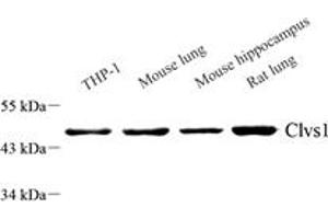Western blot analysis of Clavesin 1 (ABIN7073517) at dilution of 1: 1000,Lane 1: THP-1 cell lysate,Lane 2: Mouse lung tissue lysate,Lane 3: Mouse hippocampus tissue lysate,Lane 4: Rat lung tissue lysate (Clavesin 1 antibody)