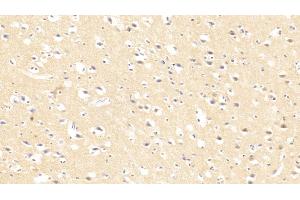 Detection of CASP3 in Human Cerebrum Tissue using Polyclonal Antibody to Caspase 3 (CASP3) (Caspase 3 antibody  (AA 183-277))