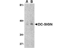 Western Blotting (WB) image for anti-CD209 (CD209) (Extracellular Domain) antibody (ABIN492511) (DC-SIGN/CD209 antibody  (Extracellular Domain))