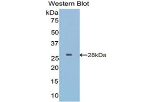 Western Blotting (WB) image for anti-Insulin-Like Growth Factor Binding Protein 5 (IGFBP5) (AA 27-248) antibody (ABIN1859309) (IGFBP5 antibody  (AA 27-248))