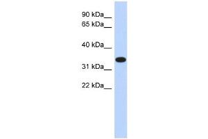 ACTRT1 antibody used at 1 ug/ml to detect target protein.