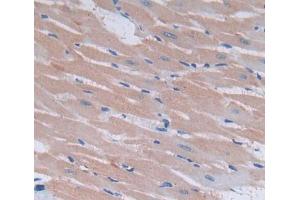 Used in DAB staining on fromalin fixed paraffin- embedded heart tissue (Endothelin 3 antibody  (AA 20-167))