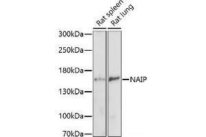 Western blot analysis of extracts of various cell lines using NAIP Polyclonal Antibody at dilution of 1:1000.