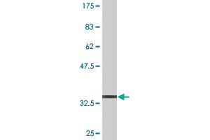 Western Blot detection against Immunogen (35. (USP45 antibody  (AA 106-196))