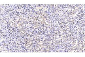 Immunohistochemistry (IHC) image for anti-WNT1 Inducible Signaling Pathway Protein 1 (WISP1) (AA 213-350) antibody (ABIN7436372)