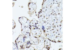 Immunohistochemistry of paraffin-embedded human placenta using HNRNPL antibody (ABIN6128048, ABIN6141915, ABIN6141917 and ABIN6216076) at dilution of 1:100 (40x lens). (HNRNPL antibody  (AA 282-589))