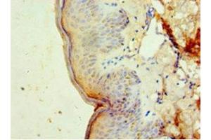 Immunohistochemistry of paraffin-embedded human skin tissue using ABIN7150514 at dilution of 1:100 (DNAJB2 antibody  (AA 2-324))