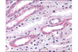 Kidney renal tubules stained with ABIN121986 (Serotonin Receptor 2B antibody  (N-Term))