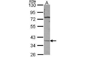 WB Image Sample (30 ug of whole cell lysate) A: A431 , 10% SDS PAGE antibody diluted at 1:500 (CA11 antibody)