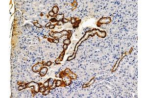 ABIN7096237 and ABIN7100299 at 1/100 staining mouse kidney tissue by IHC-P. (CXORF23 antibody)