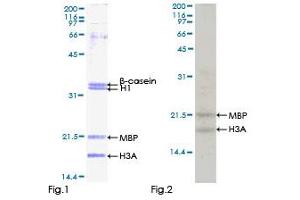 Kinase Activity Assay (KAA) image for Ribosomal Protein S6 Kinase, 90kDa, Polypeptide 5 (RPS6KA5) (AA 1-549) protein (GST tag) (ABIN1318830) (MSK1 Protein (AA 1-549) (GST tag))