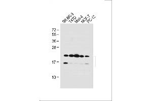 All lanes : Anti-UBE2W Antibody (C-term) at 1:1000 dilution Lane 1: SK-BR-3 whole cell lysate Lane 2: T47D whole cell lysate Lane 3: Molt-4 whole cell lysate Lane 4: MCF-7 whole cell lysate Lane 5: PC-12 whole cell lysate Lysates/proteins at 20 μg per lane. (UBE2W antibody  (C-Term))