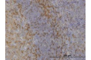 Immunoperoxidase of monoclonal antibody to MAPK12 on formalin-fixed paraffin-embedded human tonsil. (MAPK12 antibody  (AA 251-367))