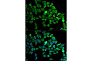 Immunofluorescence analysis of MCF-7 cells using CUL2 antibody (ABIN5975808). (Cullin 2 antibody)