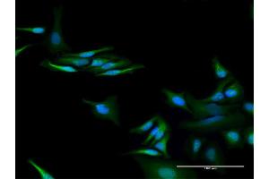Immunofluorescence of purified MaxPab antibody to C13orf18 on HeLa cell. (C13orf18 antibody  (AA 1-595))