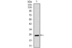 Western blot analysis using AlCAM mAb against human AlCAM recombinant protein. (CD166 antibody  (AA 405-524))