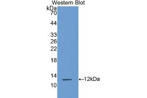 Detection of Recombinant S100A8, Rat using Polyclonal Antibody to S100 Calcium Binding Protein A8 (S100A8) (S100A8 antibody  (AA 1-89))