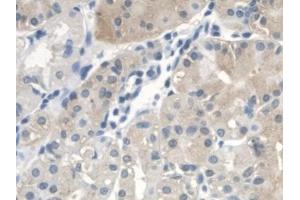 Detection of CTBS in Human Stomach Tissue using Polyclonal Antibody to Di-N-Acetyl Chitobiase (CTBS) (CTBS antibody  (AA 47-385))