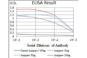 Image no. 1 for anti-E2F Transcription Factor 1 (E2F1) antibody (ABIN1491636)
