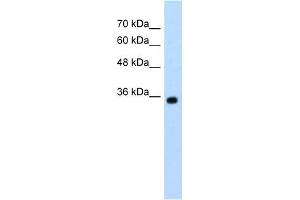 Western Blot showing ZMYND11 antibody used at a concentration of 1-2 ug/ml to detect its target protein. (ZMYND11 antibody  (N-Term))