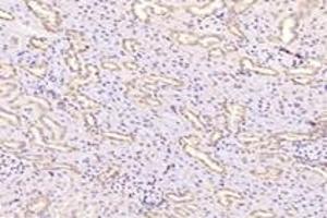 Immunohistochemistry analysis of paraffin-embedded rat kidney using,Fastkd3 (ABIN7073917) at dilution of 1: 3000 (FASTKD3 antibody)
