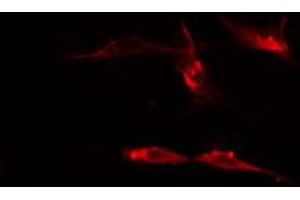 ABIN6274510 staining Hela cells by IF/ICC. (Sema4a antibody  (Internal Region))