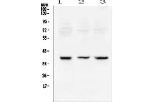 Western blot analysis of Rad51 using anti-Rad51 antibody (ABIN6719396).