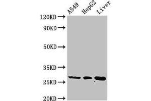 Western Blot Positive WB detected in: A549 whole cell lysate, HepG2 whole cell lysate, Rat liver tissue All lanes: PSMA5 antibody at 3 μg/mL Secondary Goat polyclonal to rabbit IgG at 1/50000 dilution Predicted band size: 27, 21 kDa Observed band size: 27 kDa