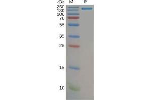 Human CD21 Protein, hFc Tag on SDS-PAGE under reducing condition. (CD21 Protein (Fc Tag))