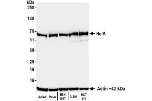 Western Blotting (WB) image for anti-Nuclear Factor-kB p65 (NFkBP65) (C-Term) antibody (ABIN7795800)