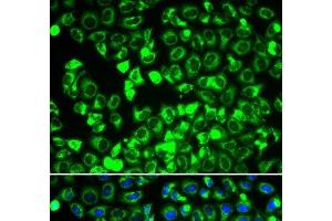 Immunofluorescence analysis of HeLa cells using DLD Polyclonal Antibody (DLD antibody)