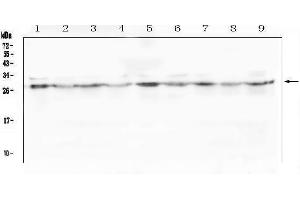 Western blot analysis of SCN4B using anti-SCN4B antibody (ABIN6719653).