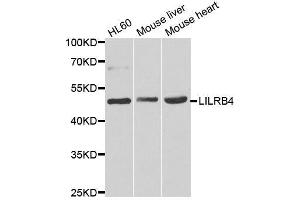 Western blot analysis of extracts of various cell lines, using LILRB4 antibody. (LILRB4 antibody  (AA 22-259))