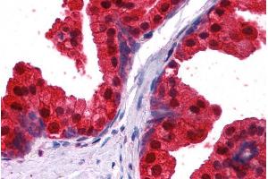 Immunohistochemistry (IHC) image for anti-N-Myc Downstream Regulated 1 (NDRG1) (C-Term) antibody (ABIN184872)