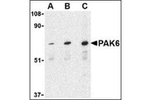 Western blot analysis of PAK6 in Raji lysate with this product at (A) 1, (B) 2, and (C) 4 μg/ml. (PAK6 antibody  (Center))