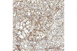 IHC analysis of PTRF/CAVIN1 using anti-PTRF/CAVIN1 antibody (ABIN7601817).