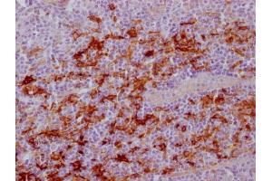 IHC image of ABIN7181209 diluted at 1:100 and staining in paraffin-embedded human tonsil tissue performed on a Leica BondTM system. (Fascin antibody)