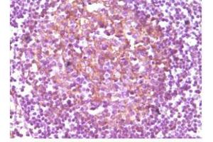 Immunohistochemical analysis of paraffin-embedded human lymphnode, showing membrane localization using CD14 mouse mAb with DAB staining. (CD14 antibody)