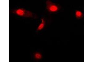 Immunofluorescent analysis of Galectin 3 staining in Jurkat cells. (Galectin 3 antibody  (Center))