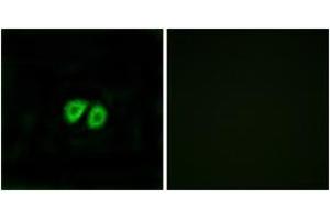 Immunofluorescence analysis of MCF7 cells, using GPR56 Antibody. (GPR56 antibody  (AA 251-300))