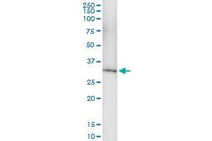 Immunoprecipitation of NUDT6 transfected lysate using anti-NUDT6 MaxPab rabbit polyclonal antibody and Protein A Magnetic Bead , and immunoblotted with NUDT6 purified MaxPab mouse polyclonal antibody (B01P) . (NUDT6 antibody  (AA 1-316))