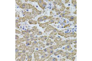 Immunohistochemistry of paraffin-embedded human liver injury using PHF1 antibody (ABIN5974685) at dilution of 1/100 (40x lens). (PHF1 antibody)