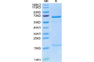 Cynomolgus PCSK9 on Tris-Bis PAGE under reduced condition. (PCSK9 Protein (AA 151-811) (His tag))