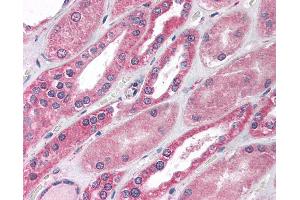 Anti-MBD1 antibody IHC of human kidney. (MBD1 antibody  (C-Term))
