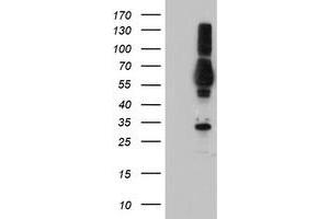 Western Blotting (WB) image for anti-Tubby Like Protein 3 (TULP3) antibody (ABIN1501585)